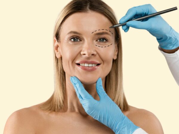 Blefaroplastia